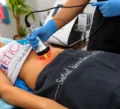 Pack Radiofrecuencia + Yesoterapia