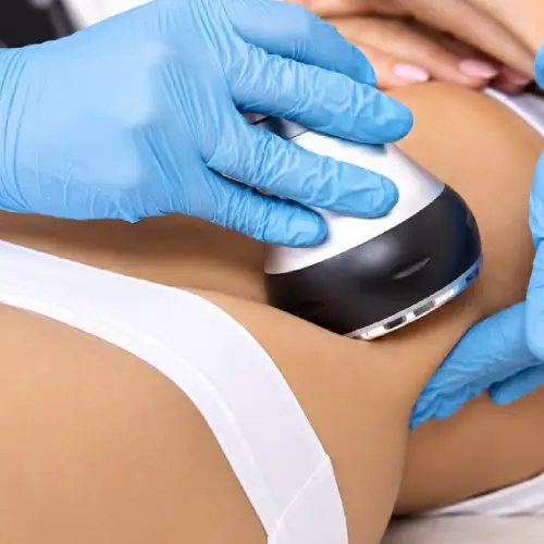 cavitacion-corporal-estetica-kinesica
