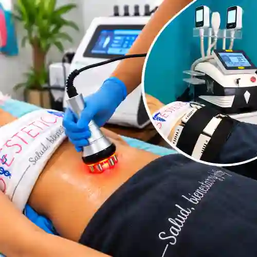 Pack Lipoláser + Radiofrecuencia