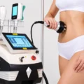 radiofrecuencia-corporal-estetica-kinesica