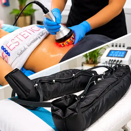Radiofrecuencia + Presoterapia en Santiago