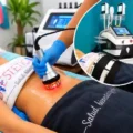 Lipoláser + Radiofrecuencia Corporal en Santiago